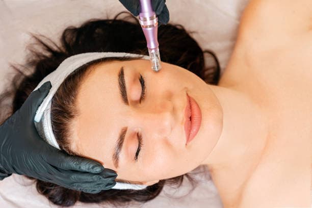 Microneedling Sherry Cosmetics
