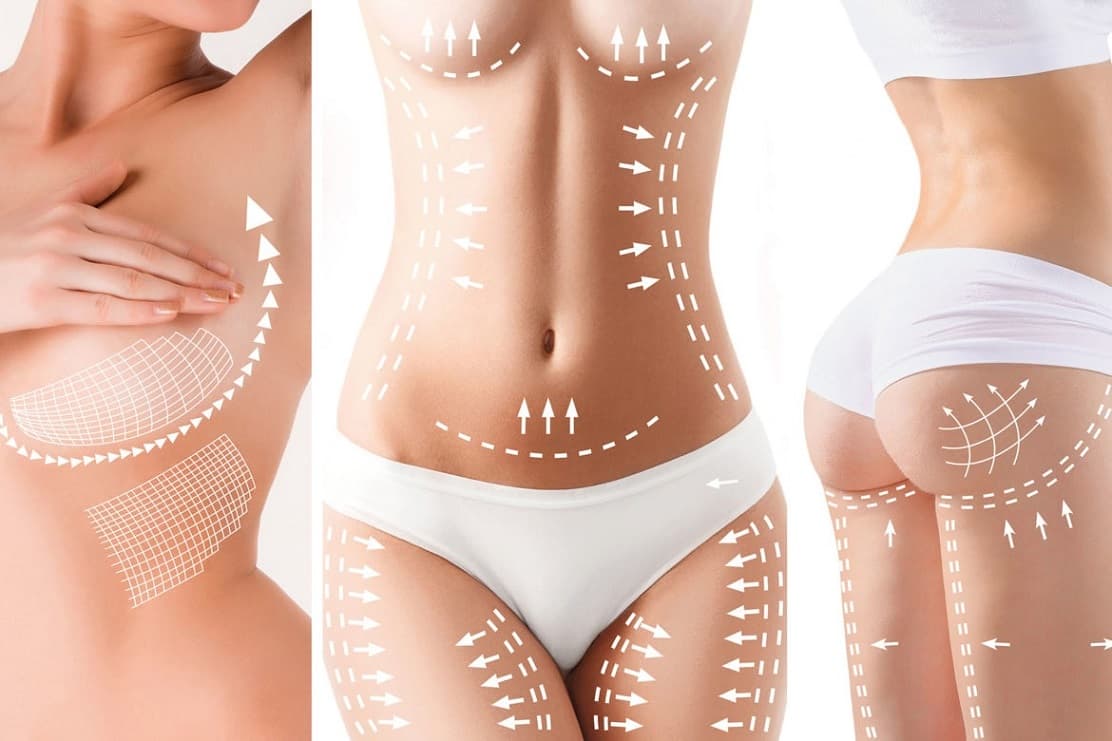 Radiofrequency (RF)