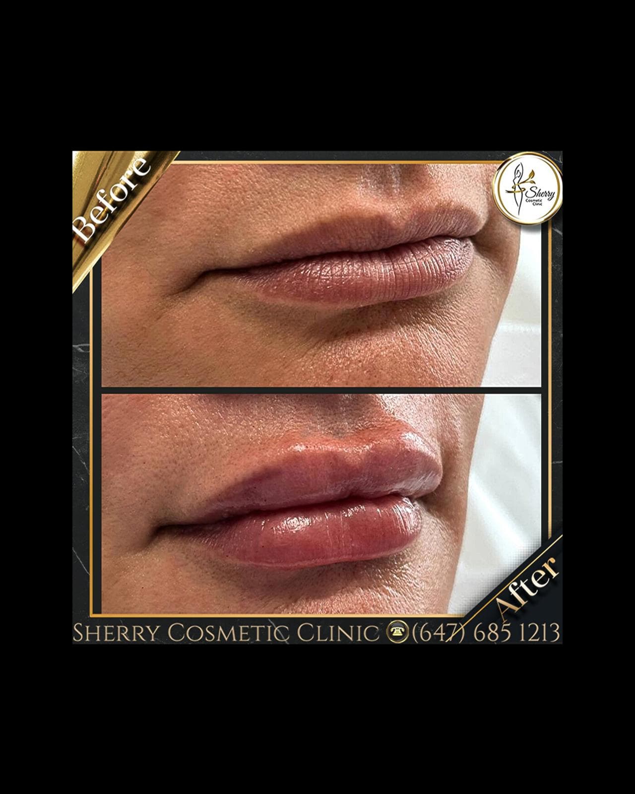 Enhancing Beauty and Confidence