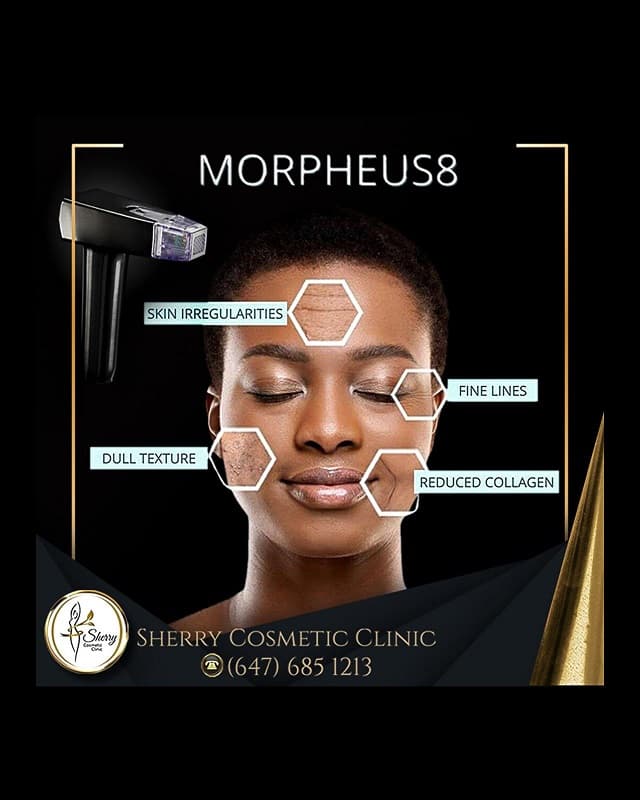 Discover the Power of Morpheus 8 at Sherry Cosmetics: A Revolutionary Skin Treatment