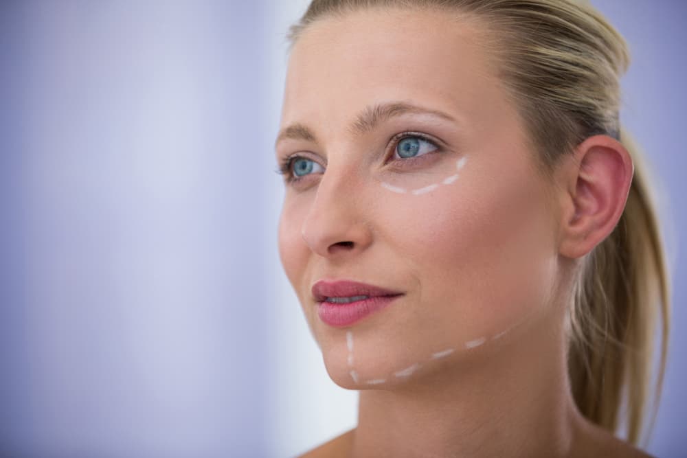 Understanding the Face Thread Lift Sherry Cosmetic Toronto