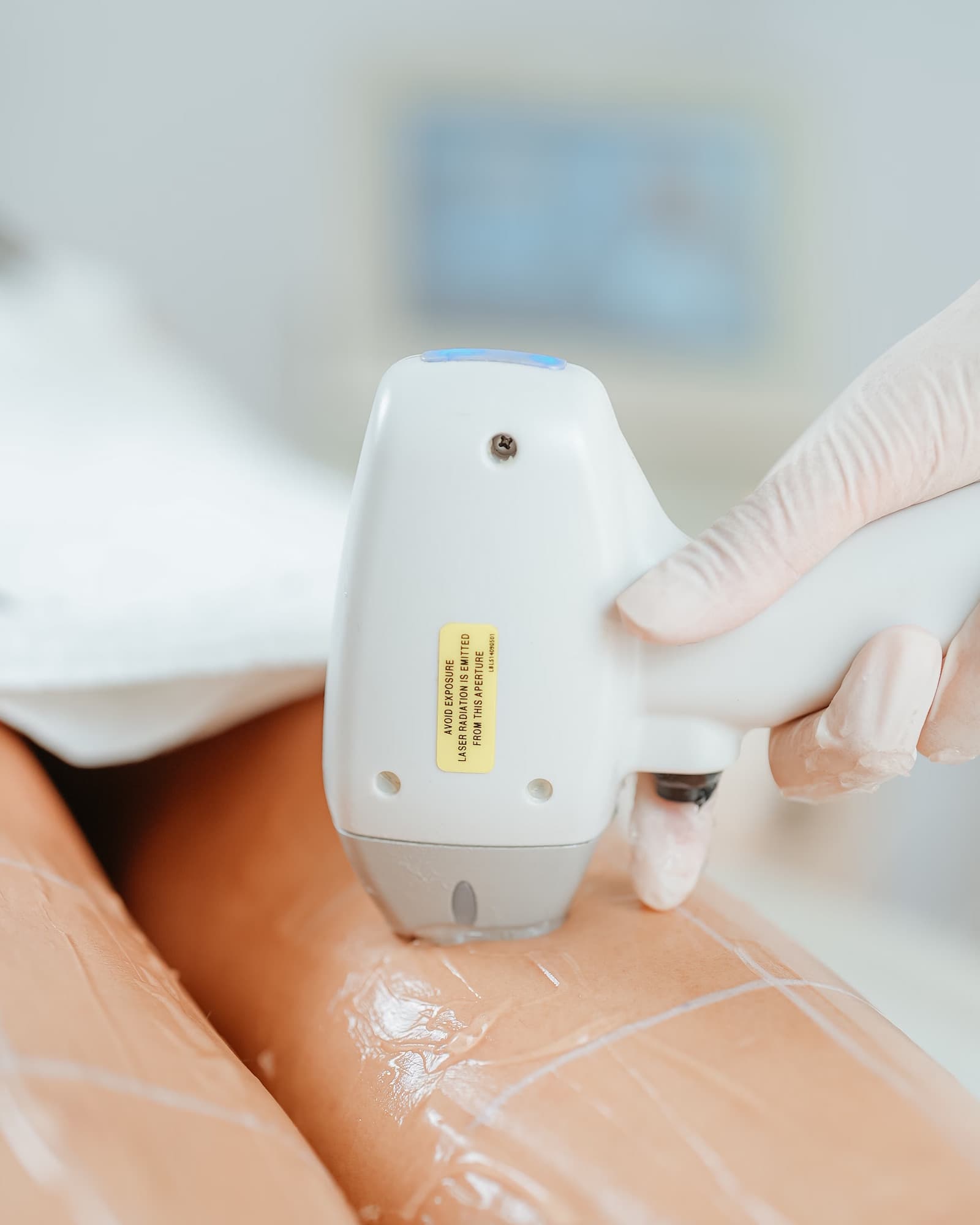 Laser Hair Removal