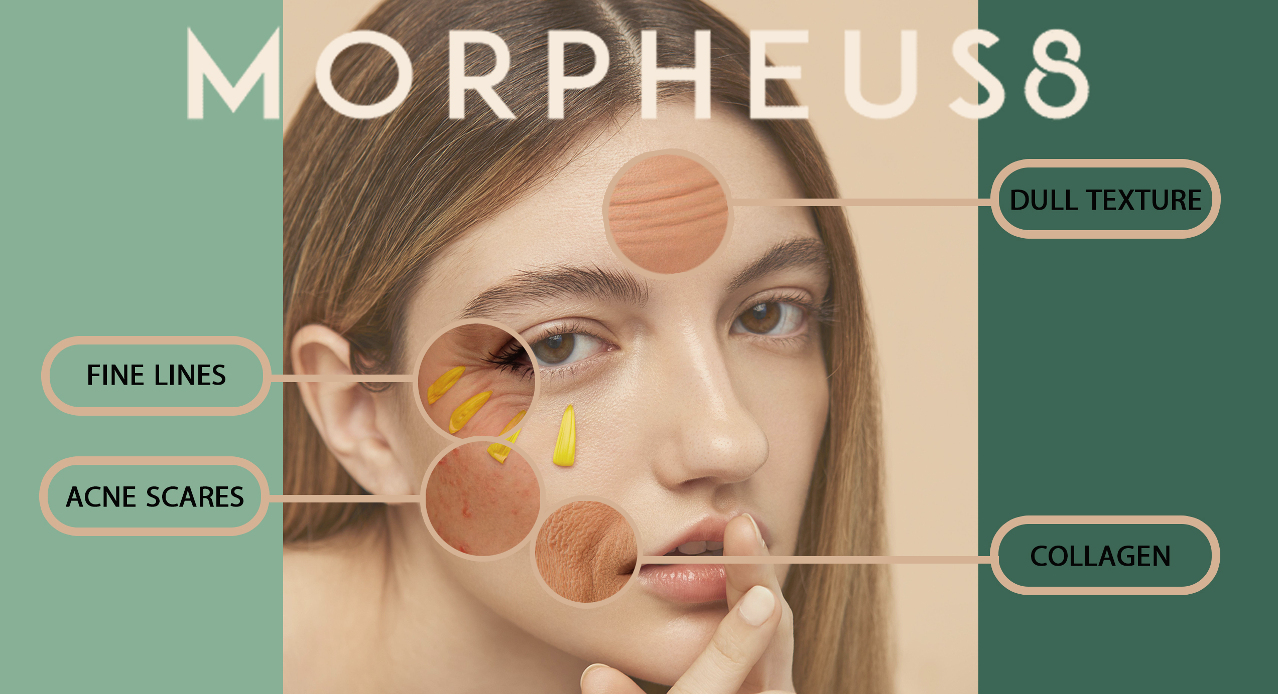 Morpheus 8