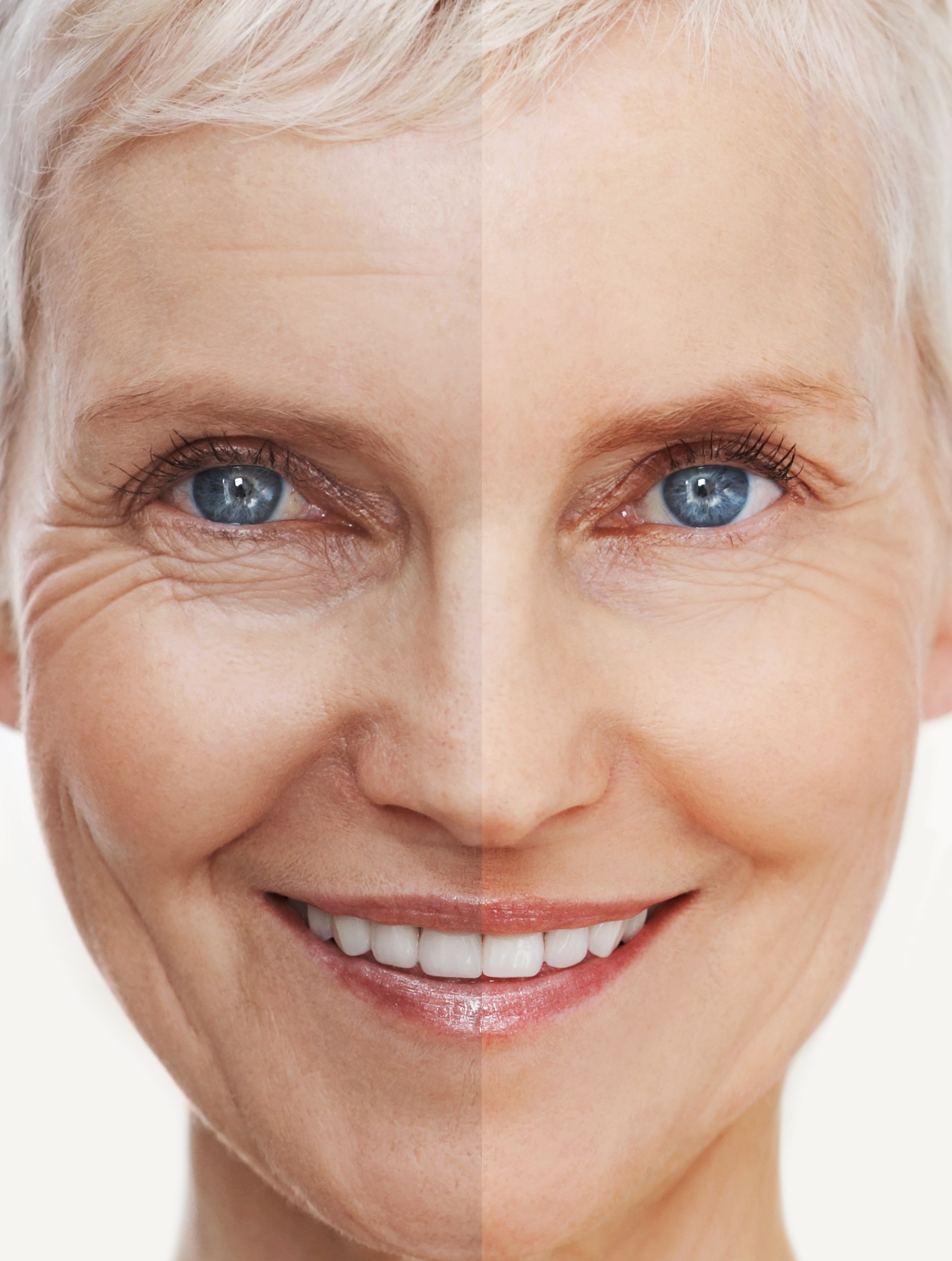 The Magic of Face Sculptra | Sherry Cosmetics